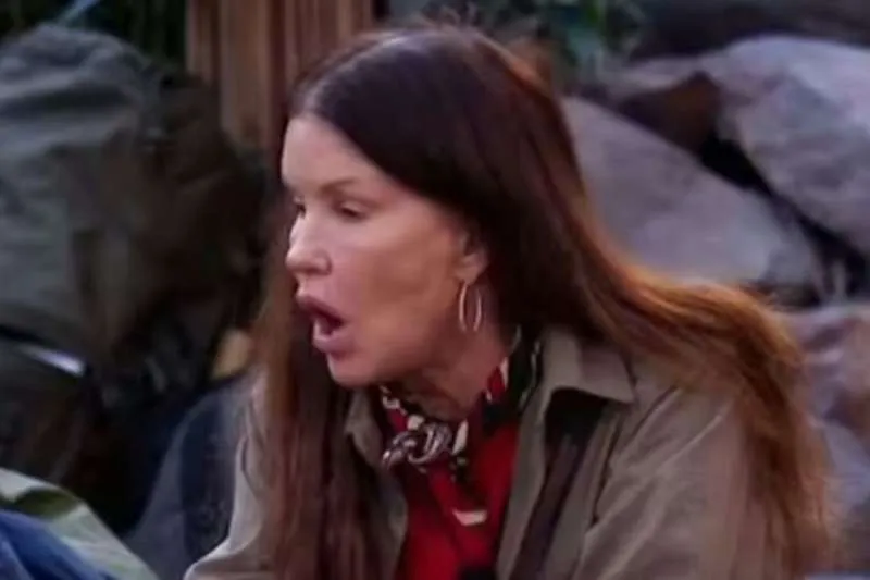 JANICE DICKINSON SUES ITV OVER I’M A CELEBRITY INJURY JANICE DICKINSON SUES ITV OVER I’M A CELEBRITY INJURY