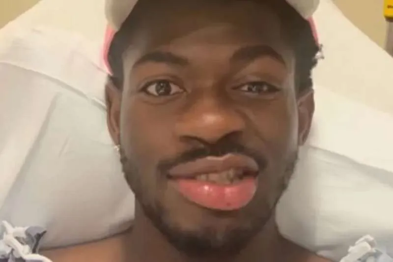 Lil Nas X Hospitalised After Health Scare Leaves Him with Facial Paralysis